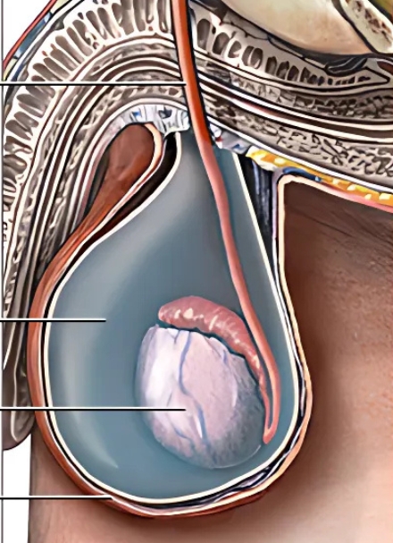 Best Hydrocele Doctors in Nizamabad